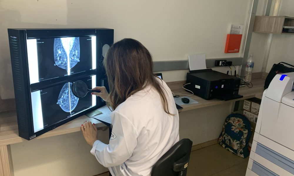 Estudo brasileiro mostra resistência de câncer de mama – 10/09/2025 – Equilíbrio e Saúde