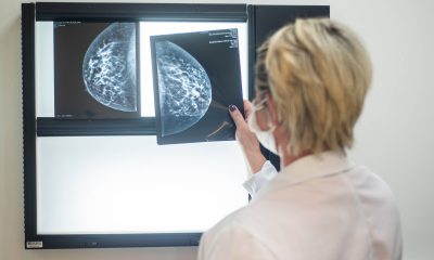 SUS garantirá mamografia a mulheres a partir de 40 anos – 23/09/2025 – Equilíbrio