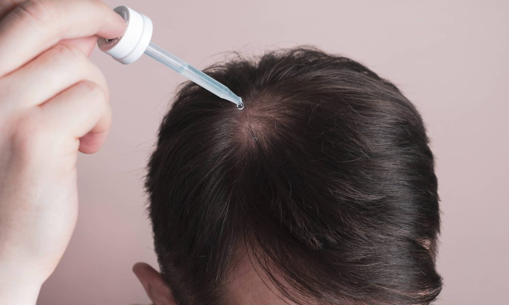 PP405, em teste nos EUA, promete reverter calvície – 22/09/2025 – Equilíbrio