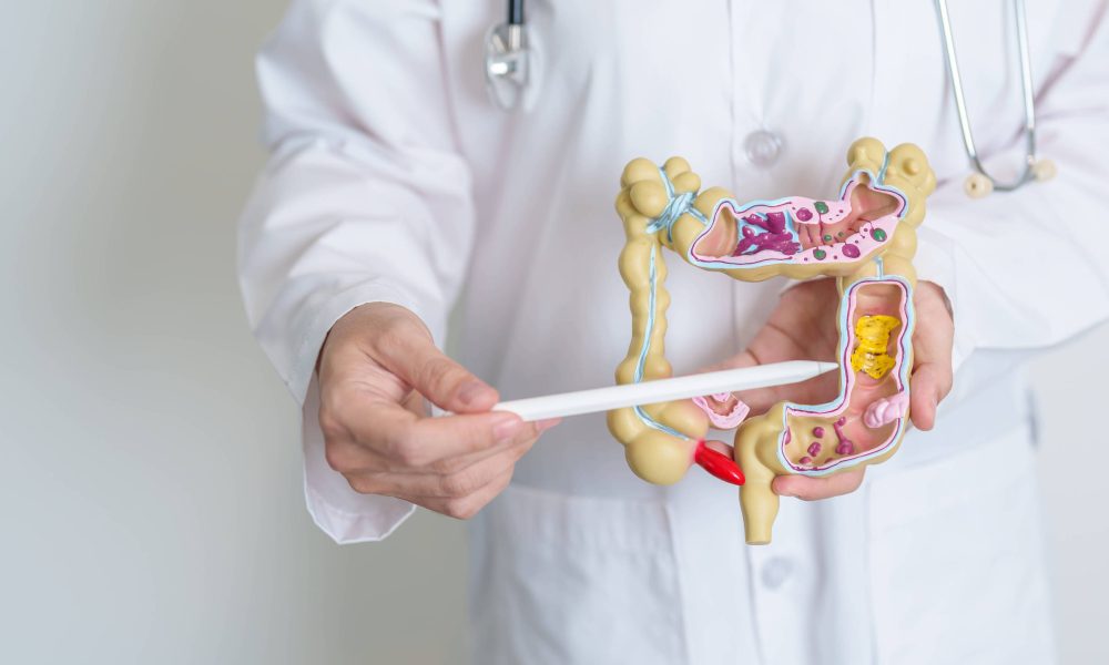 5 maneiras de reduzir o risco de ter câncer colorretal – 16/01/2026 – Equilíbrio e Saúde