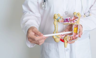 5 maneiras de reduzir o risco de ter câncer colorretal – 16/01/2026 – Equilíbrio e Saúde