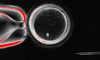 Cientistas usam células da pele para gerar óvulos – 30/09/2025 – Ciência