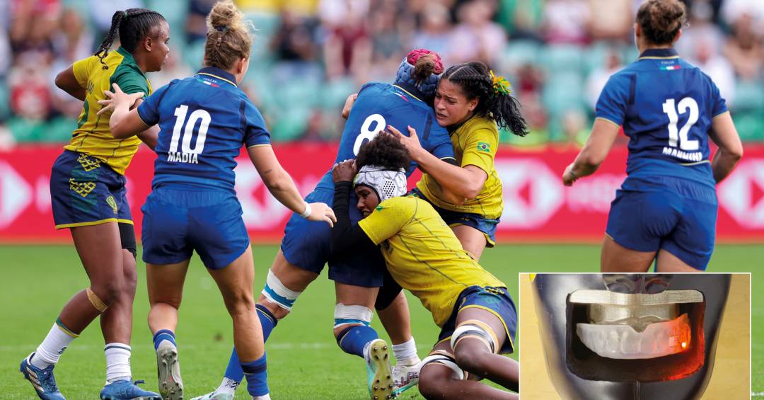 O VAR da saúde: a novidade que vem da Copa do Mundo de Rúgbi, na Inglaterra