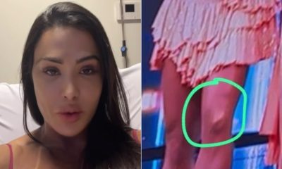 Gracyanne Barbosa se emociona ao falar sobre saída do ‘Dança dos famosos’ por lesão e ganha apoio de famosos