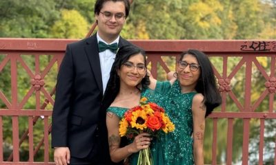 Marido de gêmea siamesa: ‘As pessoas são obcecadas para saber como fazemos sexo’