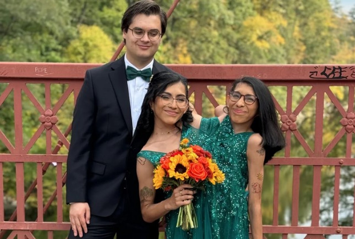 Marido de gêmea siamesa: ‘As pessoas são obcecadas para saber como fazemos sexo’