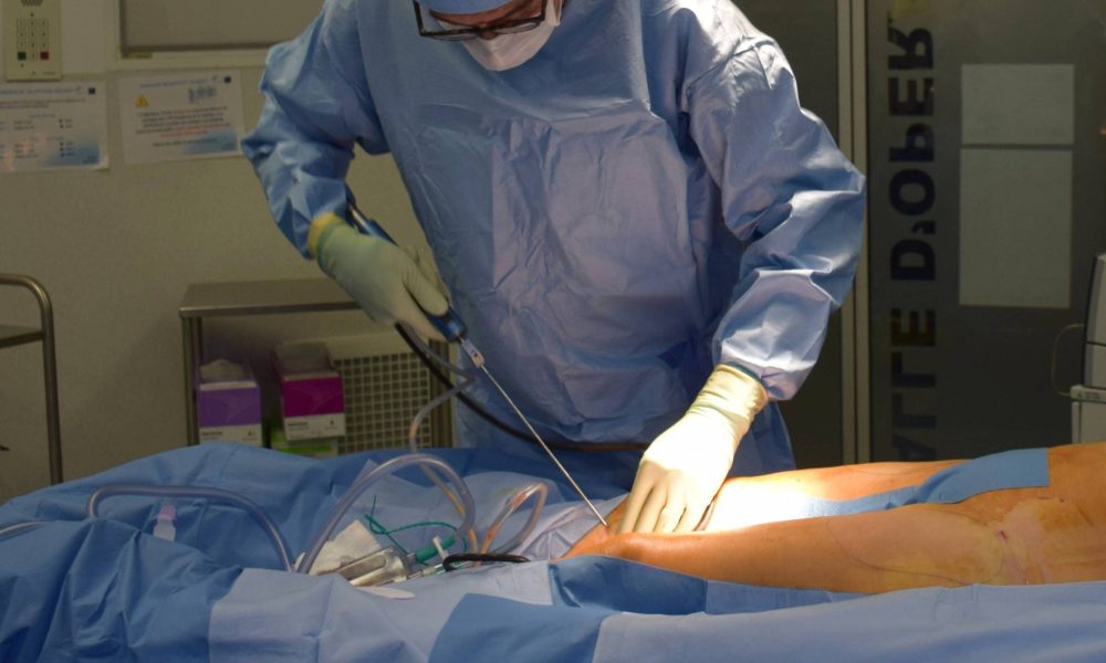 Lipoaspiração: a cirurgia plástica mais feita no Brasil – 27/10/2025 – Equilíbrio