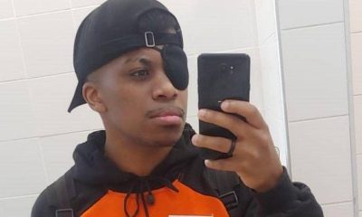 Como próteses gratuitas mudam a vida de pessoas pós câncer – 07/10/2025 – Equilíbrio e Saúde