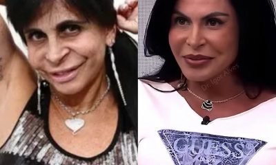 Gretchen mostra resultado de blefaroplastia: ‘Estou apaixonada’