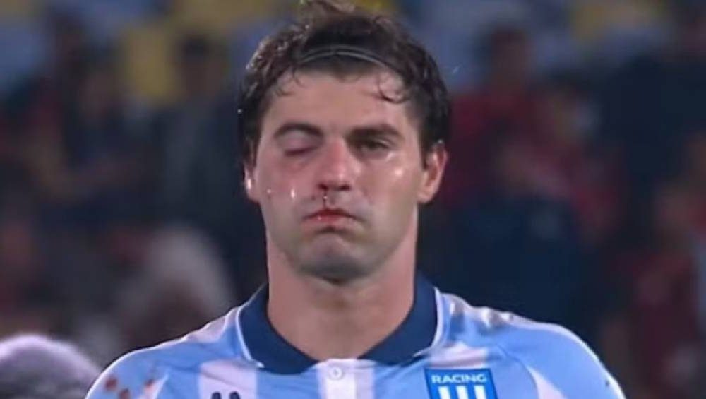 Sosa, o lutador: atacante do Racing quase sofre nocaute do próprio companheiro