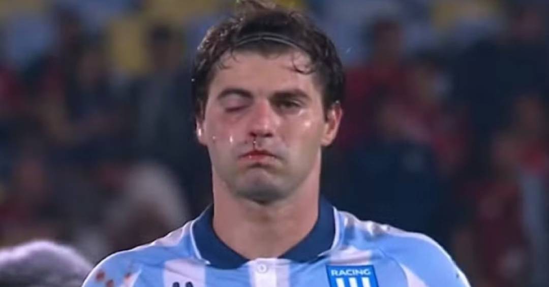 Sosa, o lutador: atacante do Racing quase sofre nocaute do próprio companheiro