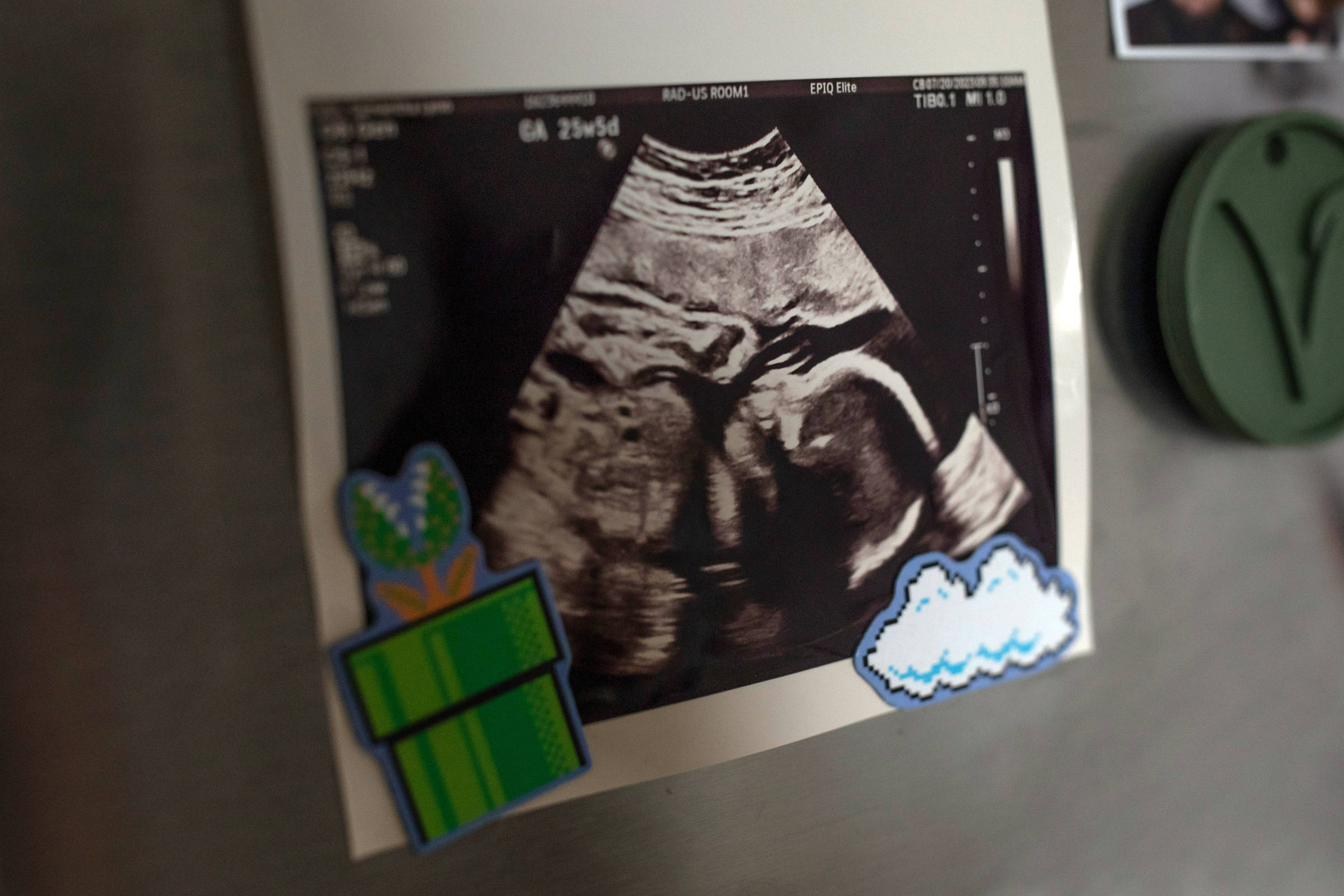 Mães e bebês são internados juntos em casos psiquiátricos – 15/01/2026 – Equilíbrio