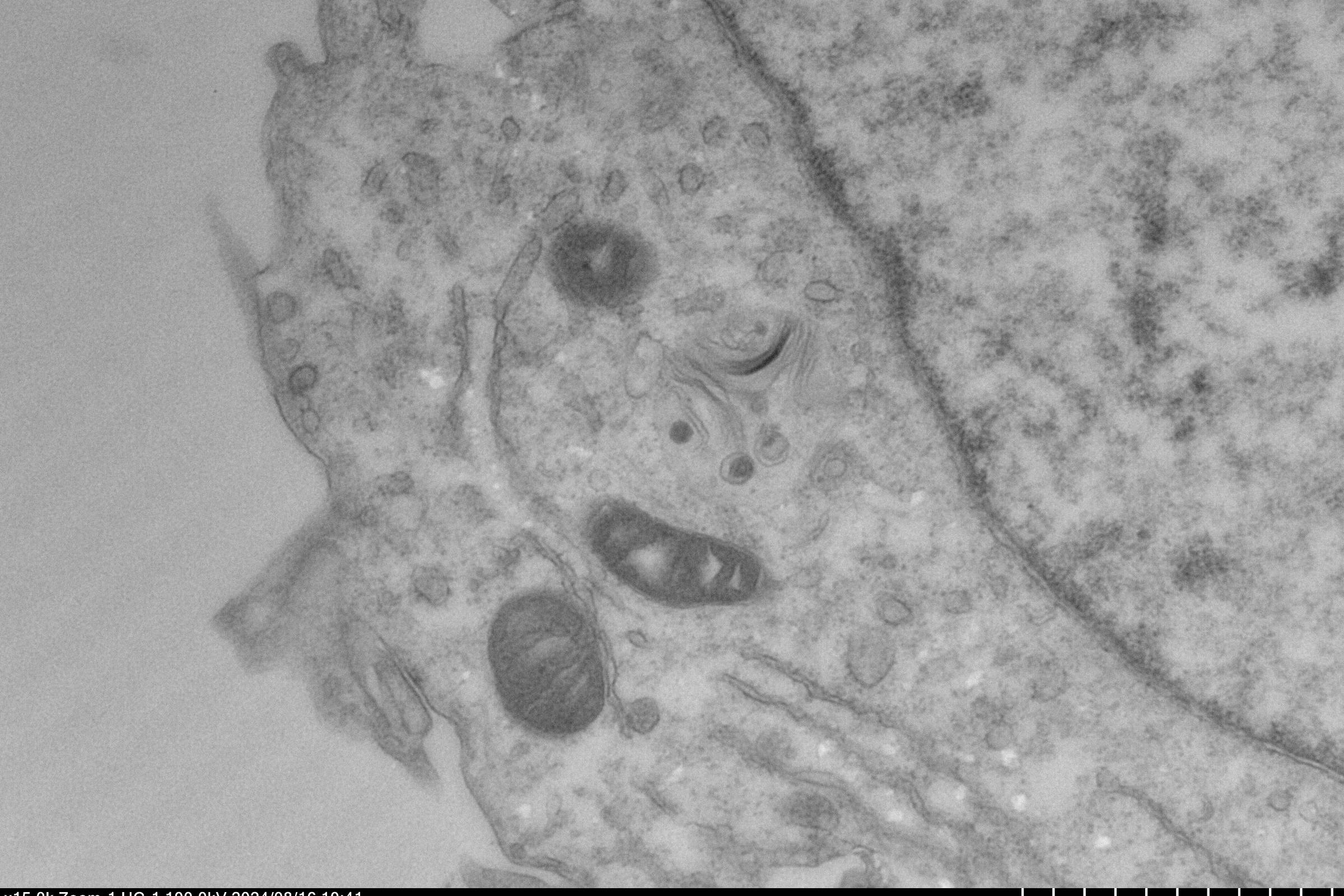 Os vírus que os especialistas estão de olho em 2026 – 18/01/2026 – Equilíbrio e Saúde