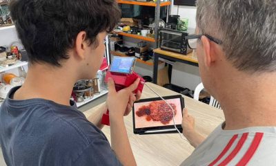 RS: Estudantes criam tecnologia que detecta câncer de pele – 15/01/2026 – Equilíbrio e Saúde