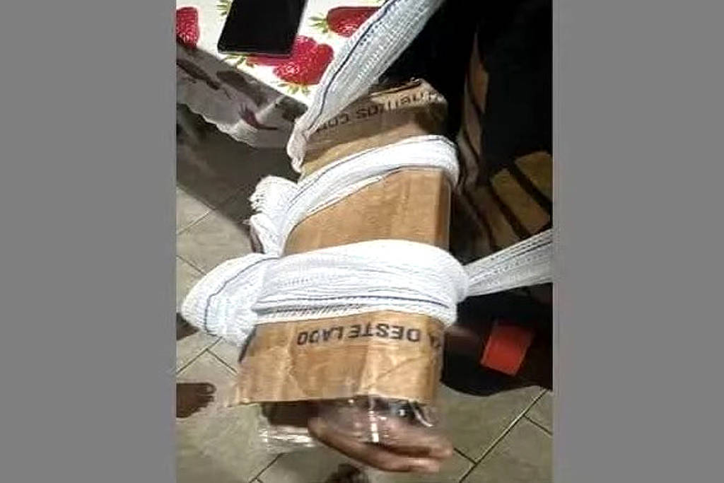 Rio: Criança tem braço imobilizado com papelão em UPA – 09/01/2026 – Equilíbrio e Saúde