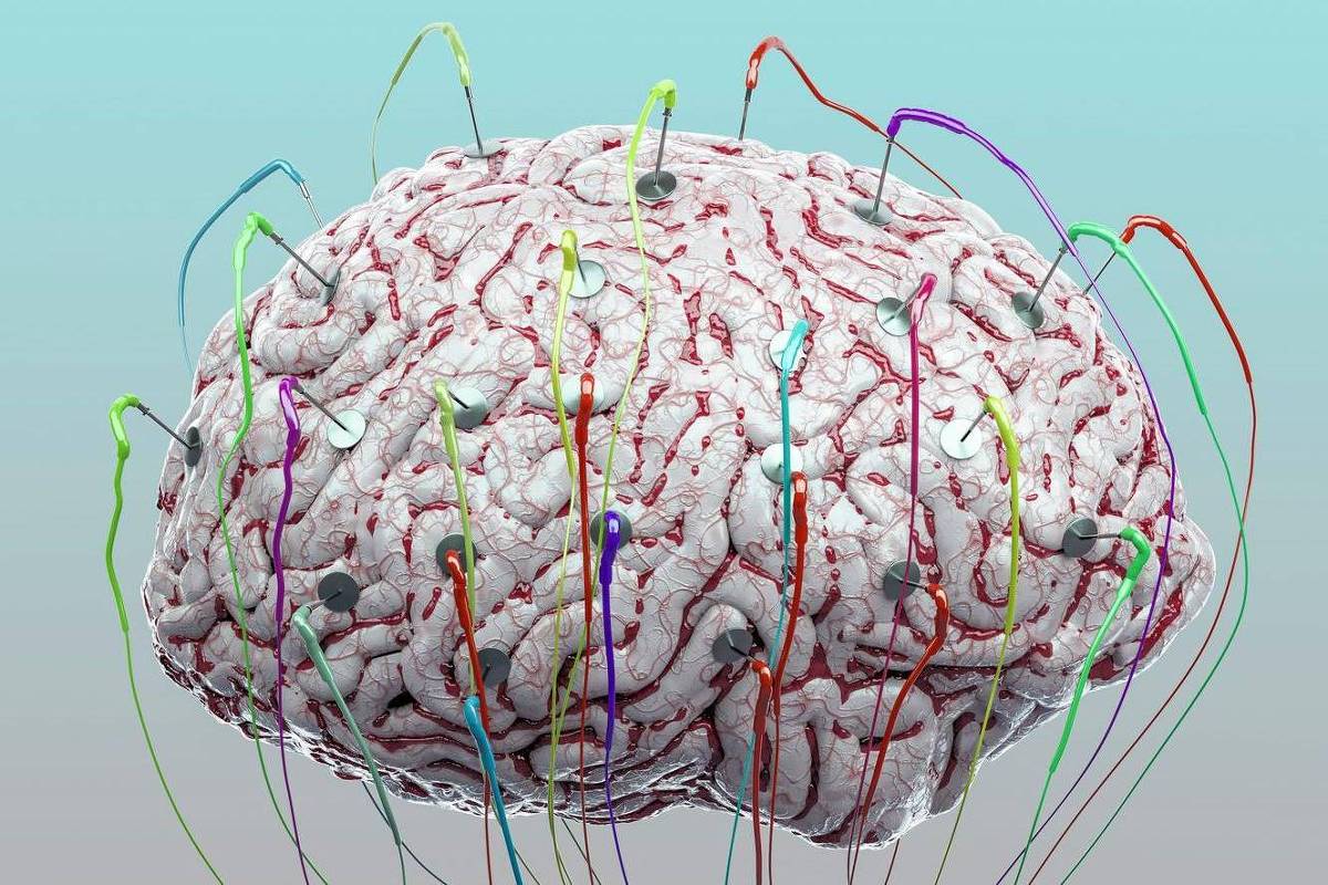A tecnologia pode fazer cérebro funcionar melhor? – 18/01/2026 – Equilíbrio