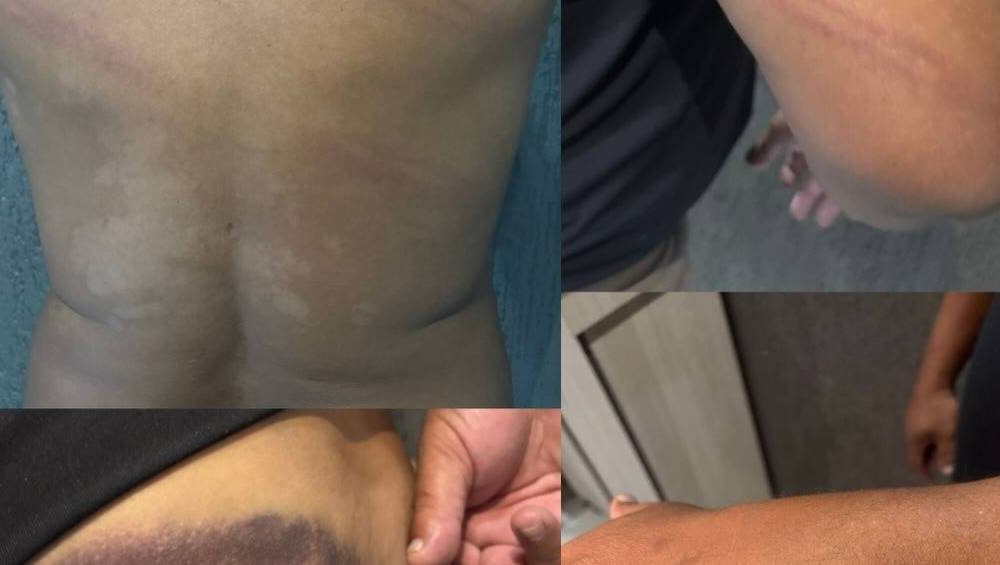 Campeão mundial pelo Inter, Perdigão é agredido por policiais no Paraná; confira vídeo